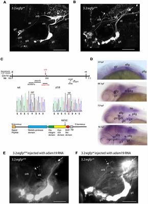 The Metalloproteinase adam19b Is Required for Sensory Axon Guidance in the Hindbrain